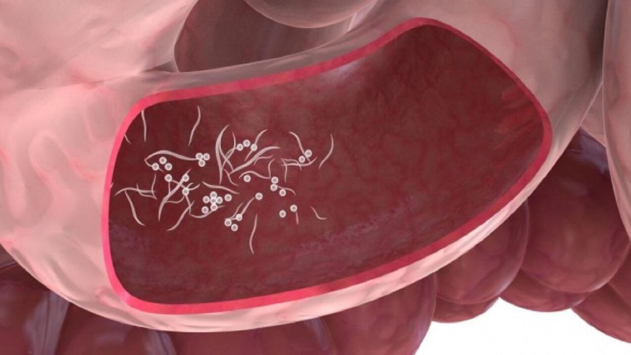 Giardia paraziták a májban