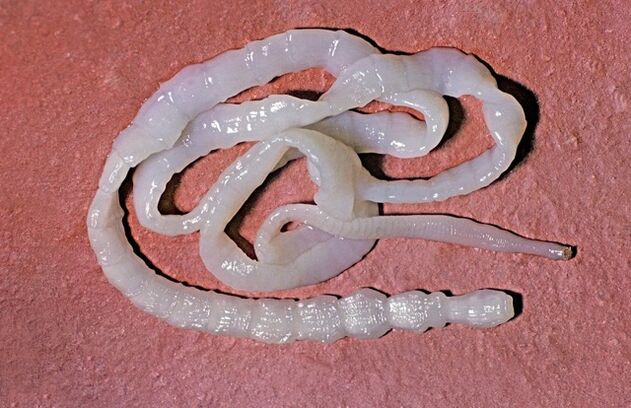 hogy néz ki a bika galandféreg