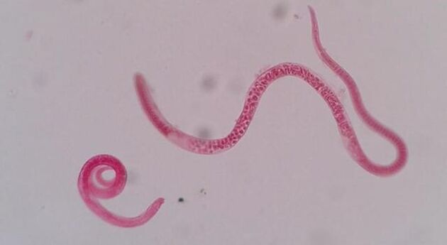 hogy néz ki a trichinella