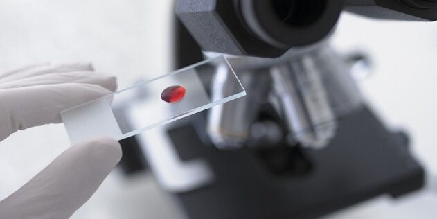 vérvizsgálat a szervezetben lévő paraziták diagnosztizálására